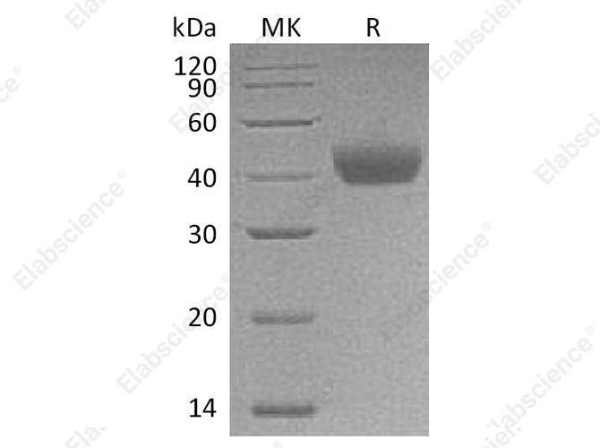 Recombinant Rat CD38 Protein (His Tag) - 1