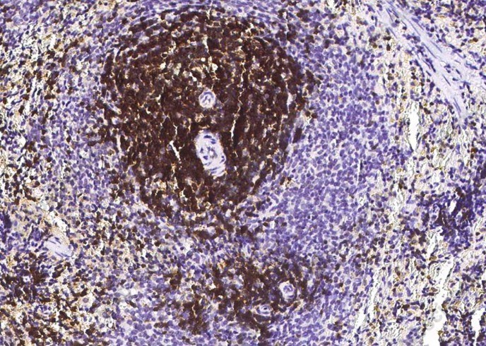CD6/Cluster of Differentiation 6 Monoclonal Antibody - 2