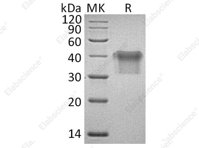 Recombinant Human IL2Ra/CD25 Protein (His Tag) - 1