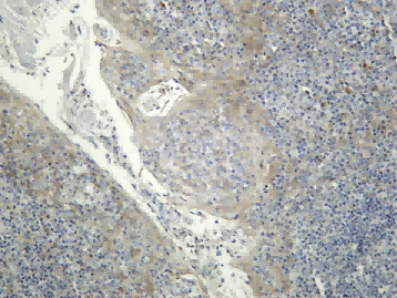 Recombinant CYR61 Monoclonal Antibody - 1