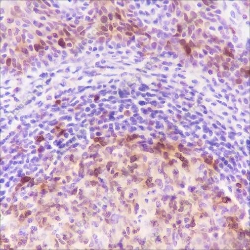 Recombinant Stathmin Monoclonal Antibody - 3