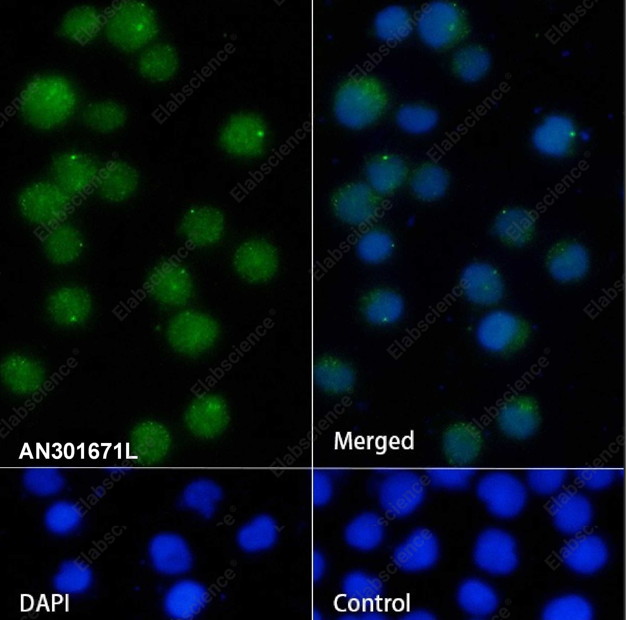 Recombinant TCL1 Monoclonal Antibody - 2