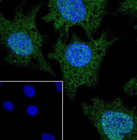 Recombinant Rad51 Monoclonal Antibody - small - 4