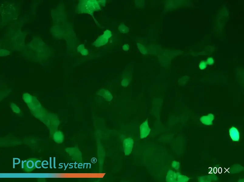 MC38-GFP - 6