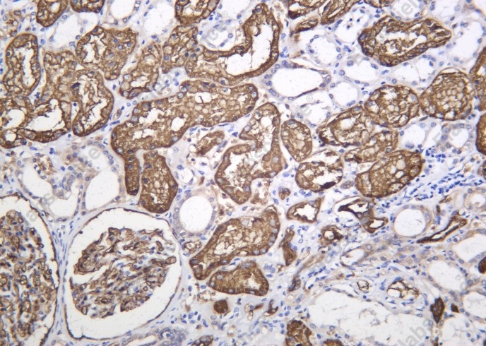 Recombinant AQP1 Monoclonal Antibody - 1