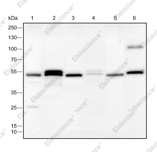 Recombinant FLI1 Monoclonal Antibody - 1