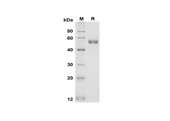 Recombinant Human CXCL9/MIG Protein(Trx Tag)-产品推荐-1