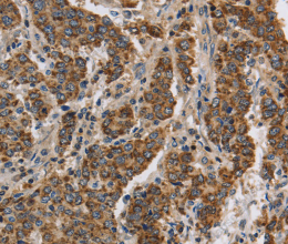 KCNQ4 Polyclonal Antibody - 2