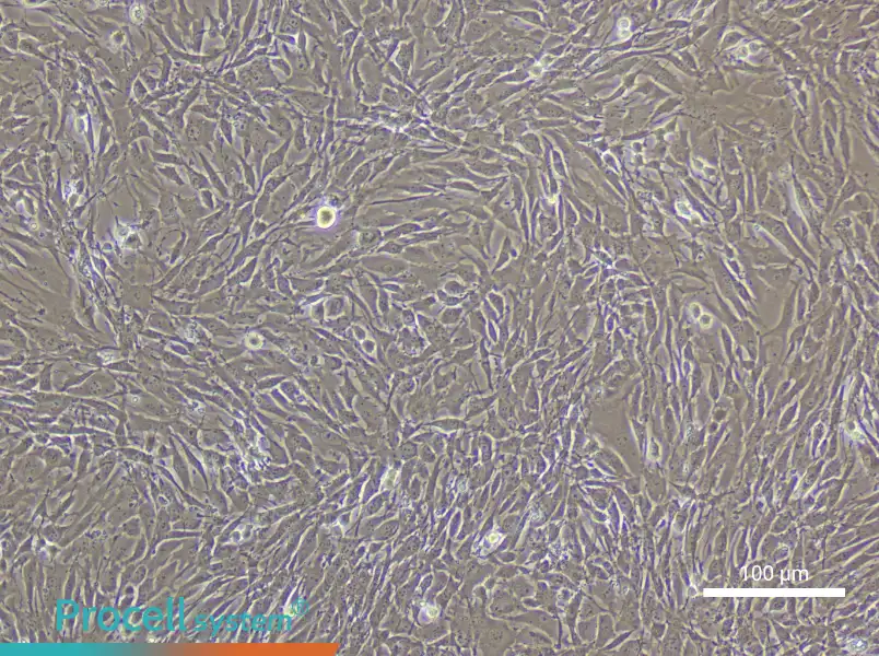 Mouse Pulmonary Great Artery Smooth Muscle Cell Complete Medium - 2