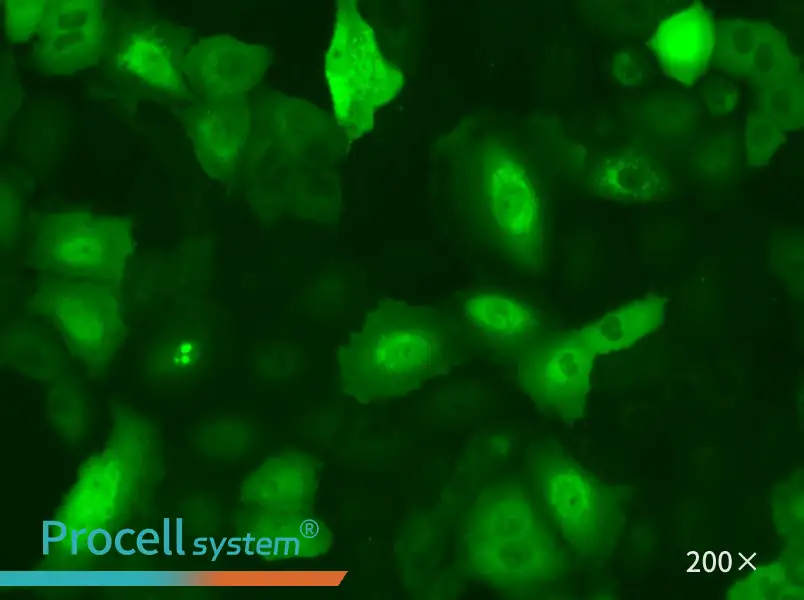 A549-GFP - 6