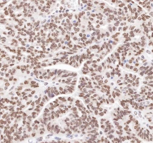 Recombinant APE1 Monoclonal Antibody-searchlist-2