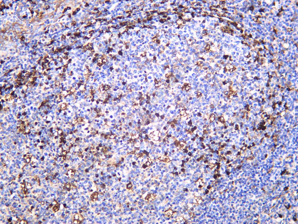 Recombinant LGMN Monoclonal Antibody - 2