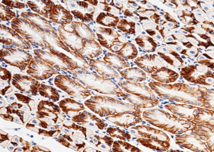 Recombinant CXADR Monoclonal Antibody-searchlist-1