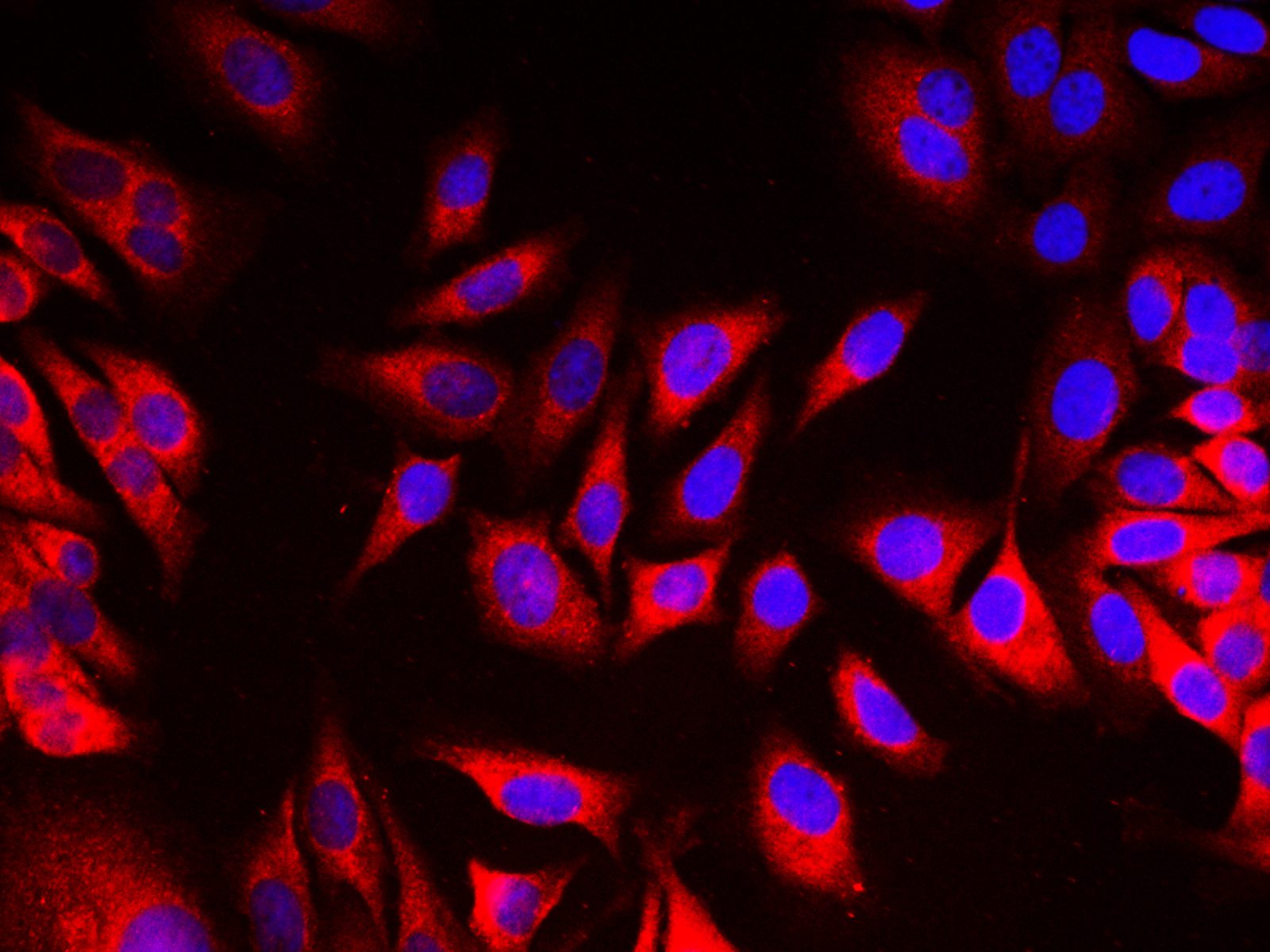 EEF2 Polyclonal Antibody - small - 7