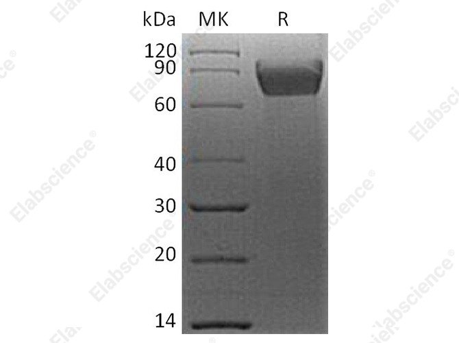 Recombinant Human B7-H4/VTCN1 Protein (mFc Tag) - 1