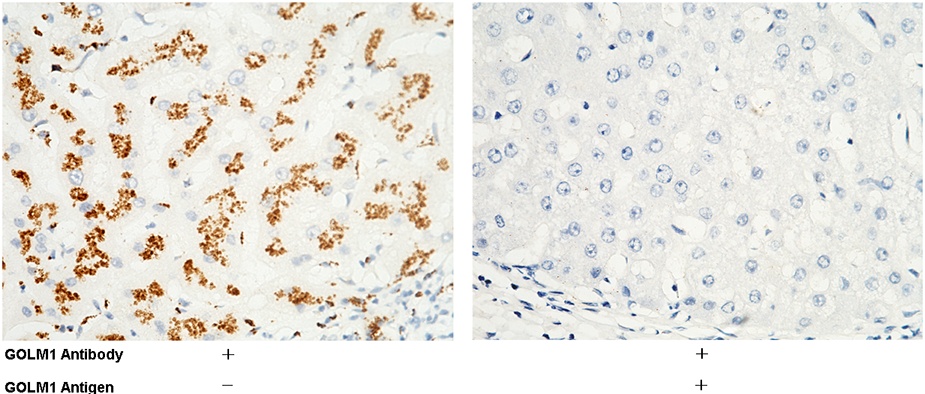 Recombinant GOLM1/GP73 Monoclonal Antibody - small - 2