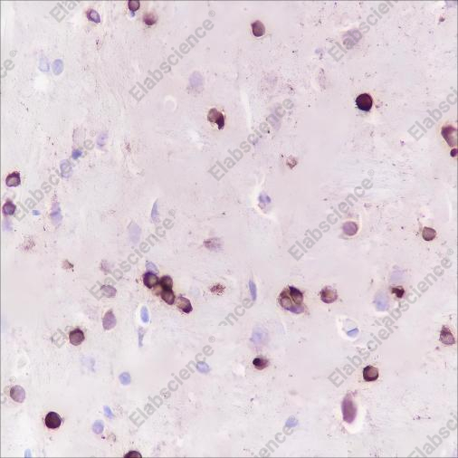 Recombinant Alpha B Crystallin Monoclonal Antibody - 6