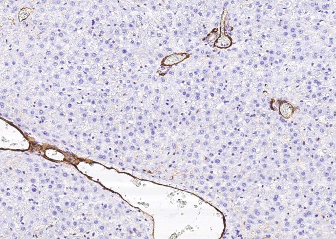 Recombinant BCAM/CD239 Monoclonal Antibody - small - 2