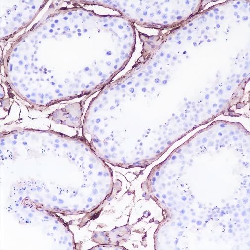 Recombinant DPEP1 Monoclonal Antibody - 2