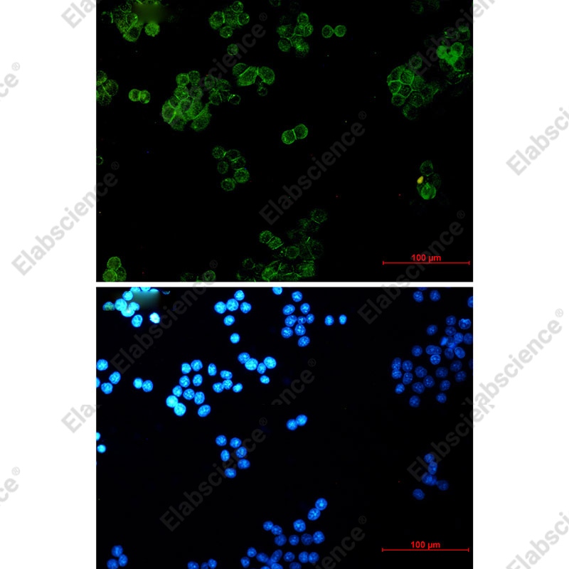 Recombinant gamma Catenin Monoclonal Antibody - 3