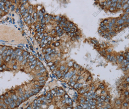 NDUFA9 Polyclonal Antibody - 2