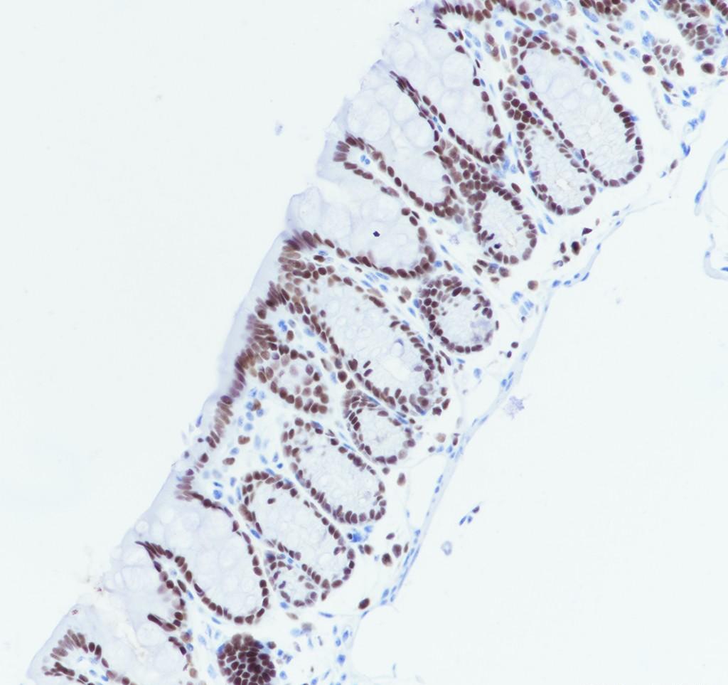 Recombinant SMARCC2/BAF170 Monoclonal Antibody - small - 4