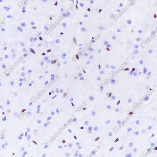 Recombinant ERG Monoclonal Antibody - 4