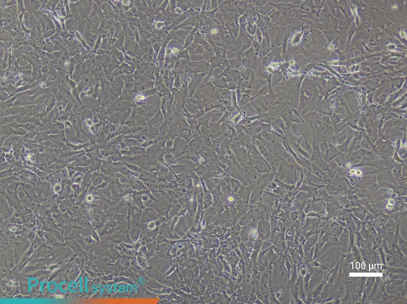 Rat Pulmonary Artery Fibroblast Complete Medium - 1