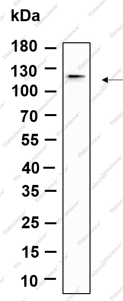 Recombinant DDR1 Monoclonal Antibody - 1
