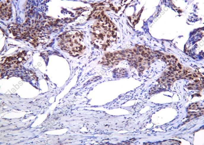 Recombinant Histone H4 (Acetyl Lys8) Monoclonal Antibody - 1
