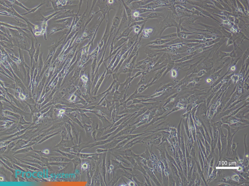 Human Pulmonary Artery Smooth Muscle (Primary cell immortalization) Cell Complete MediumHuman Pulmonary Artery Smooth Muscle (Primary cell immortalization) Cell Complete Medium - 2