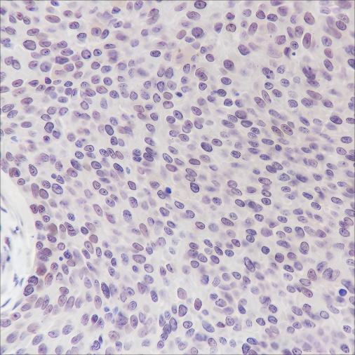 Recombinant Cyclin D3 Monoclonal Antibody - 3