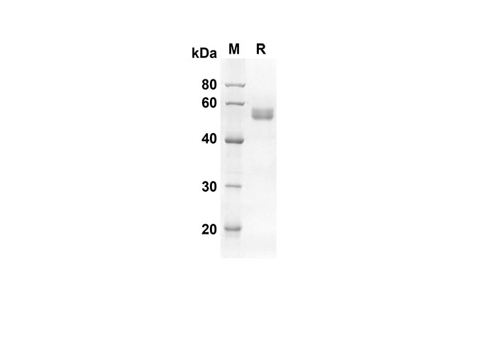 Recombinant Human IL15 Protein-产品推荐-1