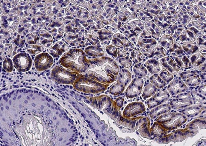 Recombinant Syndecan-4/SDC4 Monoclonal Antibody - small - 2