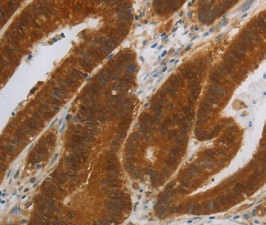 NIT2 Polyclonal Antibody - 2