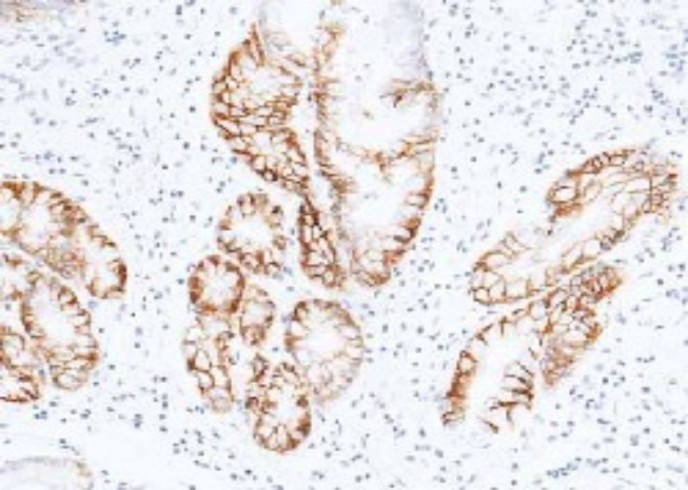 Recombinant Carbonic Anhydrase IX/CA9 Monoclonal Antibody - small - 2