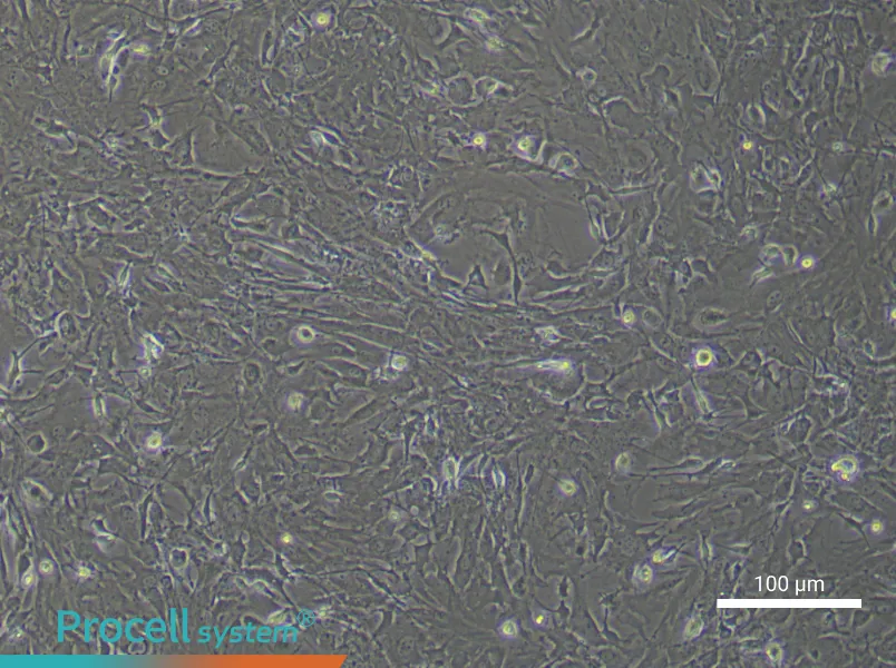 Mouse Spinal Cord Fibroblasts - 1