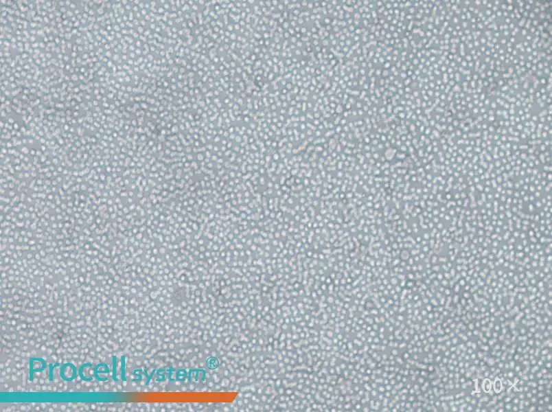 skm-1 Cell Complete Medium - 3