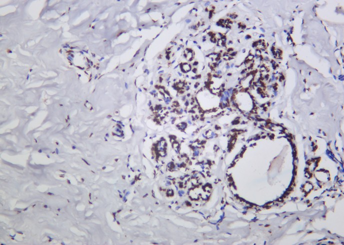 Recombinant Phospho-p53 (Ser15) Monoclonal Antibody-searchlist-1