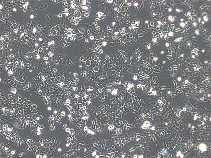 Ishikawa Cell Complete Medium - 2