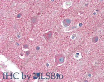 CLTC Polyclonal Antibody - 4