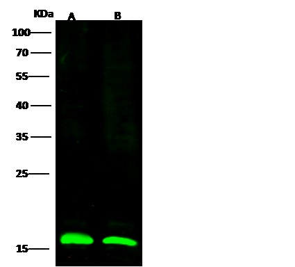 LC3B/MAP1LC3B Polyclonal Antibody - small - 2