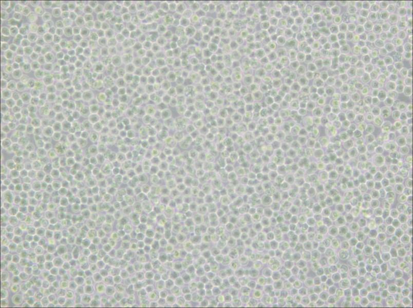 Ramos [RA 1] Cell Complete Medium - 5