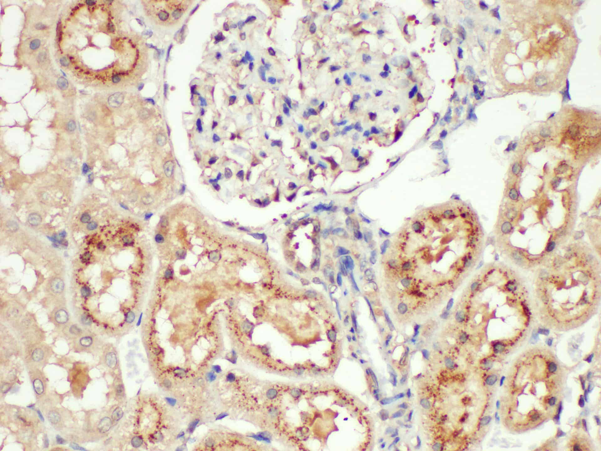 Purified Anti-Mouse Ly-6G/Ly-6C (Gr-1) Antibody[RB6-8C5]-产品推荐-6
