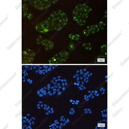 Recombinant BAP31 Monoclonal Antibody - 4