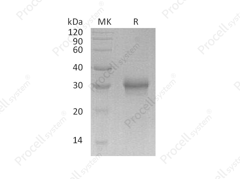FGF-17 (C-6His), Human, Recombinant