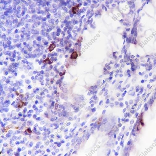 Recombinant Phospho-S6 Ribosomal Protein (Ser240, 244) Monoclonal Antibody - 3