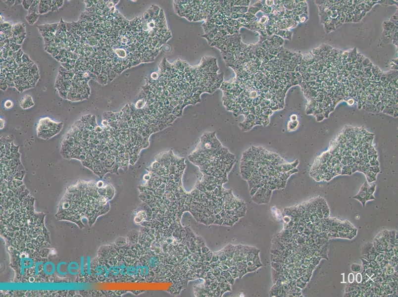 BT-474 [BT474] Cell Complete Medium - 1