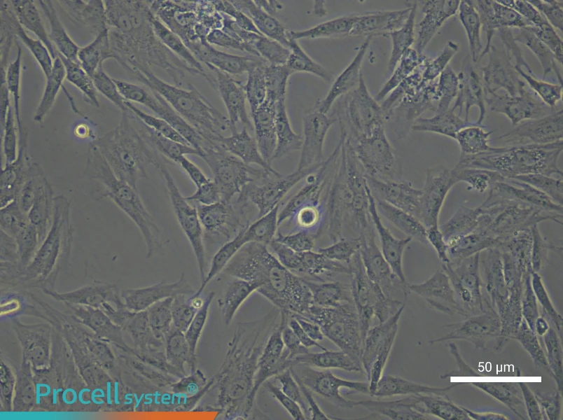 Rat Trabecular Meshwork Cell Complete Medium - 4
