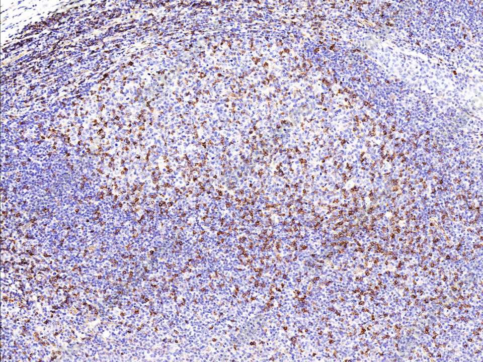Recombinant IFITM1 Monoclonal Antibody - 1
